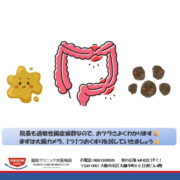 過敏性腸症候群とは…??のアイキャッチ画像