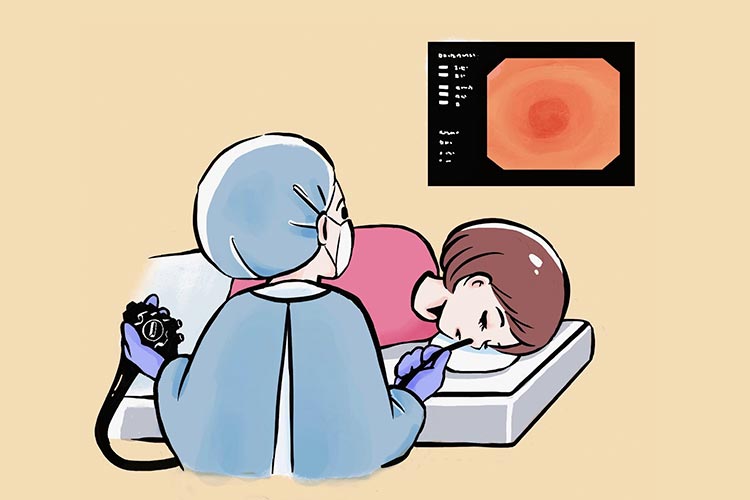 鼻から胃カメラを挿入する様子のイラスト